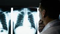 Surgeon compares chest xrays on lightboard